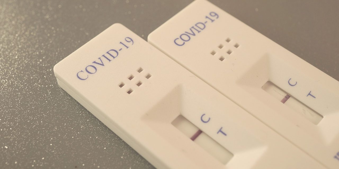Testes para Covid-19 não servem para medir nível de anticorpos, alerta Anvisa