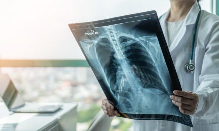 Exames de radiografia em Louveira não precisam de agendamento