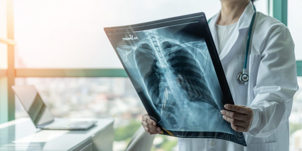 Exames de radiografia em Louveira não precisam de agendamento