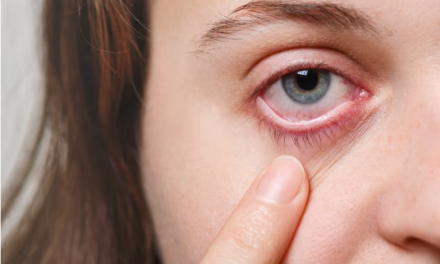 Herpes ocular: apesar de rara, doença pode levar à cegueira se não for tratada a tempo, alerta especialista