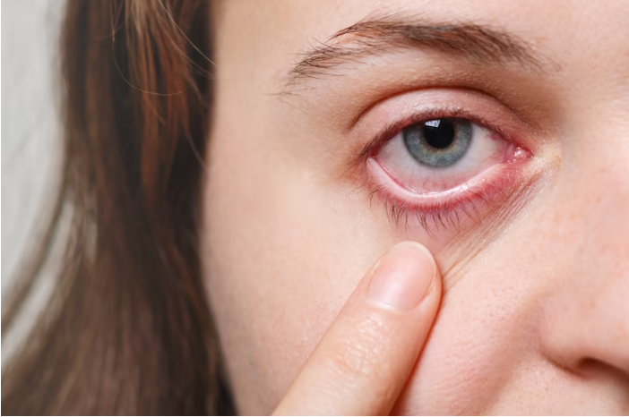 Herpes ocular: apesar de rara, doença pode levar à cegueira se não for tratada a tempo, alerta especialista